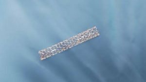 冠脉支架喷涂 - 支架医疗涂层制备 - 超声喷涂 - 驰飞超声波